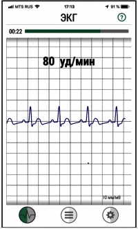 Инструкция мини кардиограф ИКРЗ-1